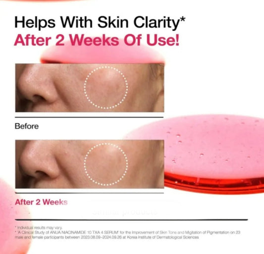 Anua Niacinamide 10% + TXA 4% DARK SPOT serum
